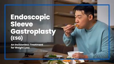 Endoscopic Sleeve Gastroplasty (ESG) package Thumbnail